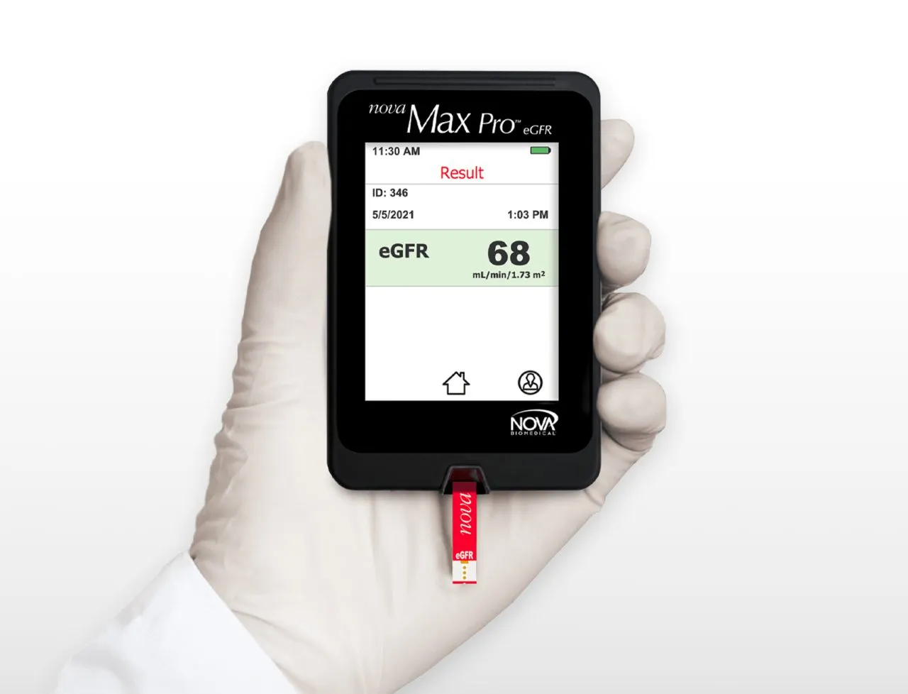 Máy đo creatinin/eGFR Nova Max Pro